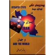 بیماری های انگلی هیداتید سیست در ایران و جهان